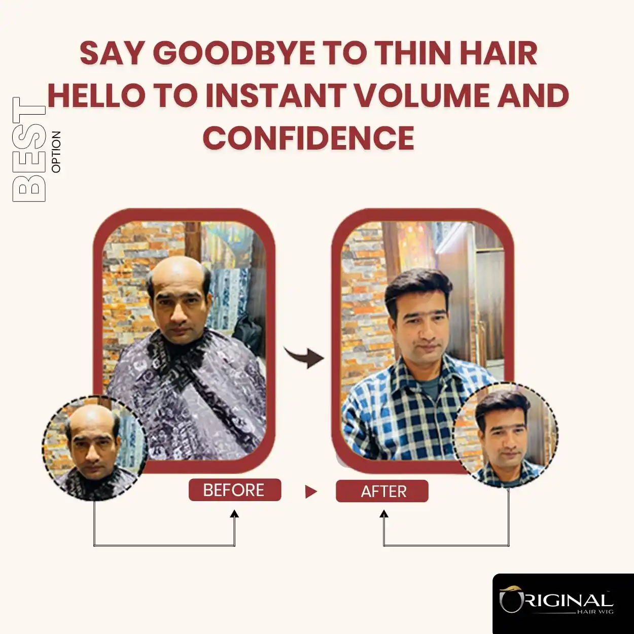 Natural Black Golden USA Hair Patch Easy Fix with Tape Glue and Clips